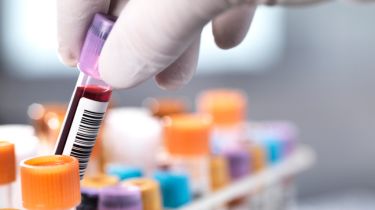 PATHOLOGY Subharti Medical College